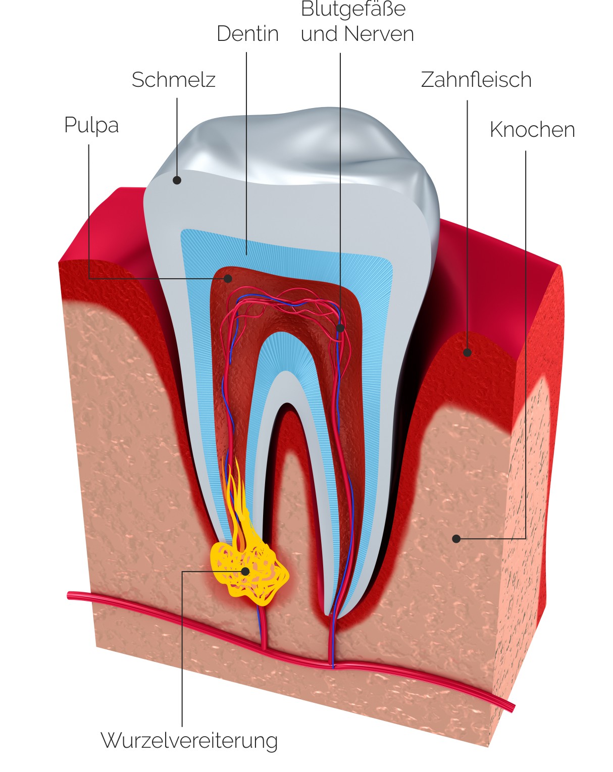 Zahnarztpraxis Roetgen Wurzelkanalbehandlung Alternative Zahnverlust