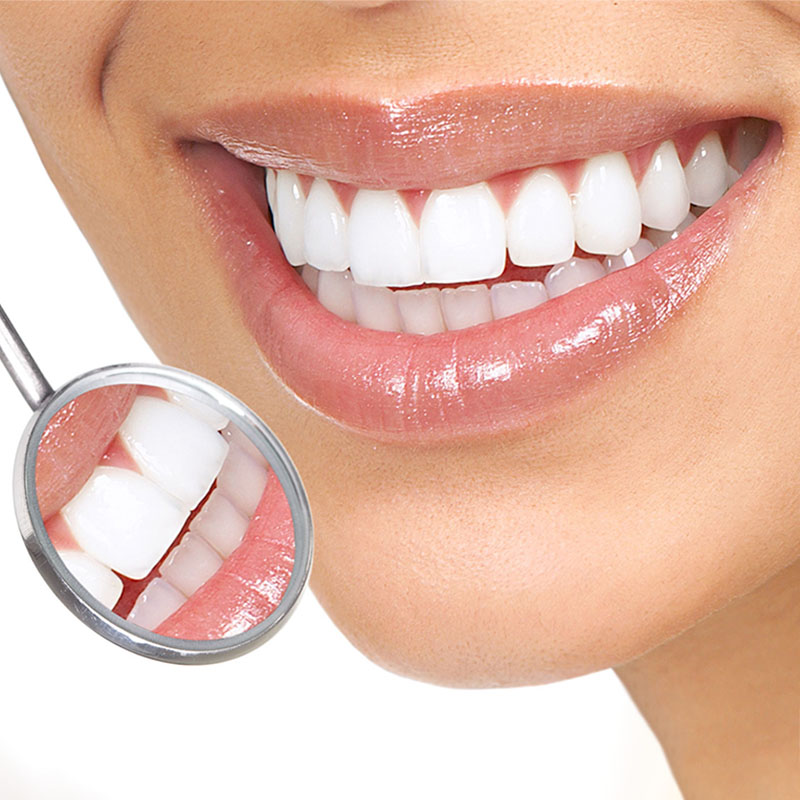 Zahnarztpraxis-Roetgen-Prophylaxe - professionelle Zahnreinigung
